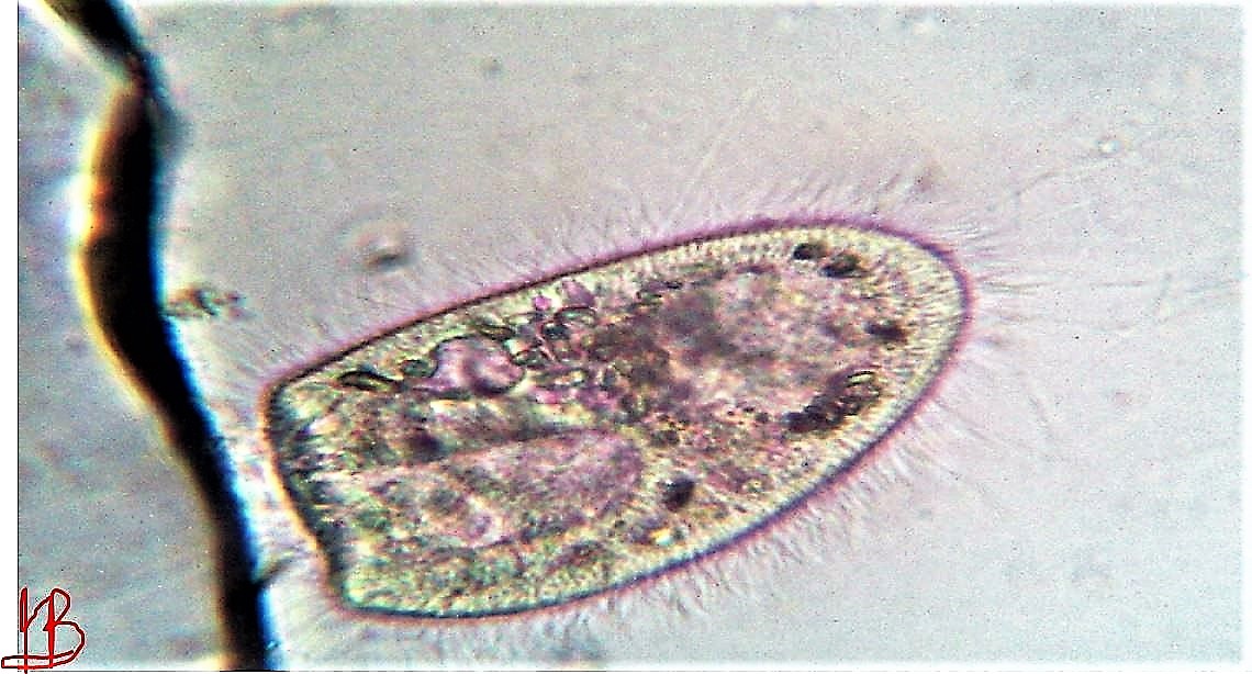 ciliato Bursaria truncatella